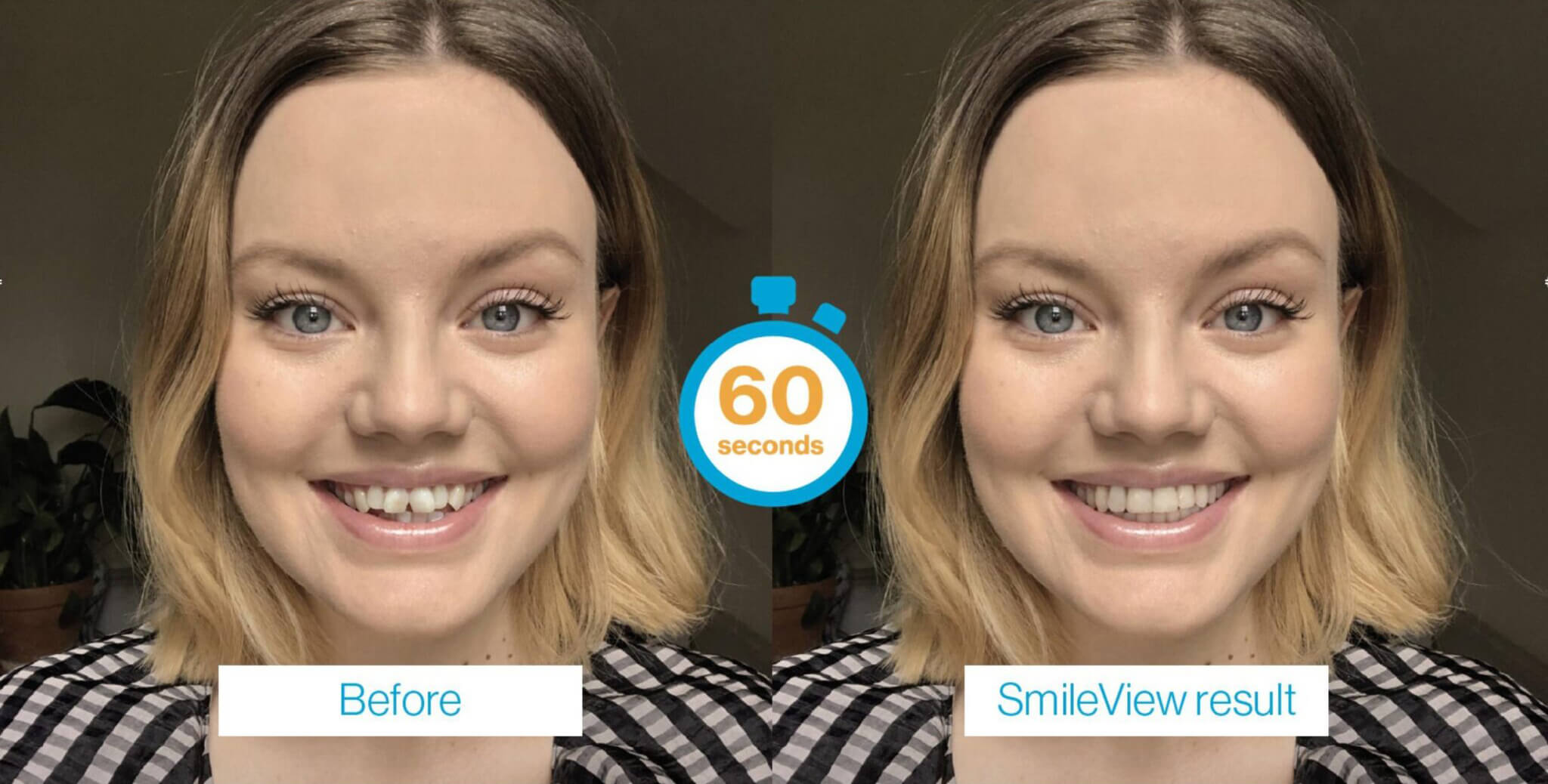 Smile View Experience